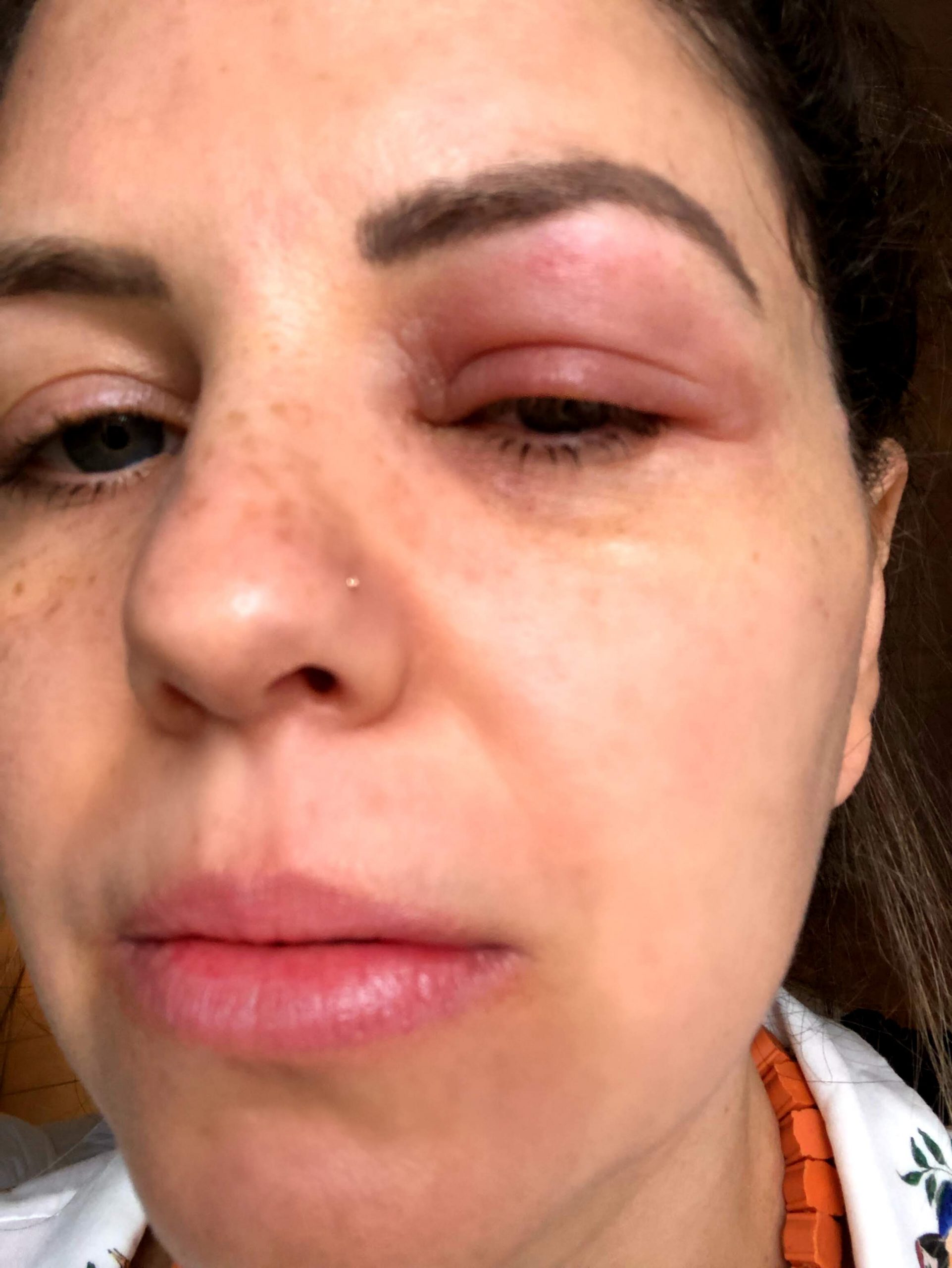 Veja O Que Fazer Quando For Atacada Por Percevejos Ou Bed Bugs